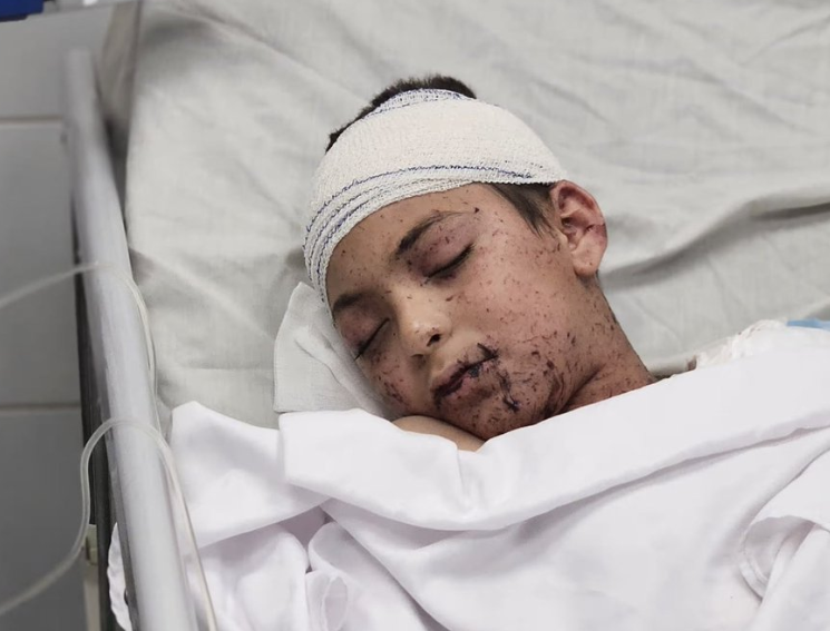 Serangan Israel di Khan Younis, Tewaskan Hampir Seluruh Keluarga Seorang Dokter